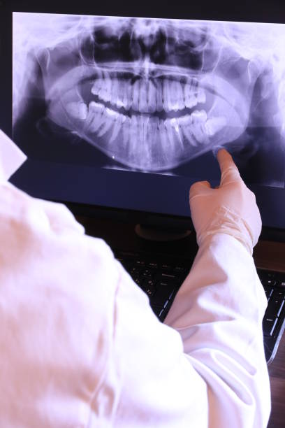 Best Dental Abscess Treatment in Milford, DE